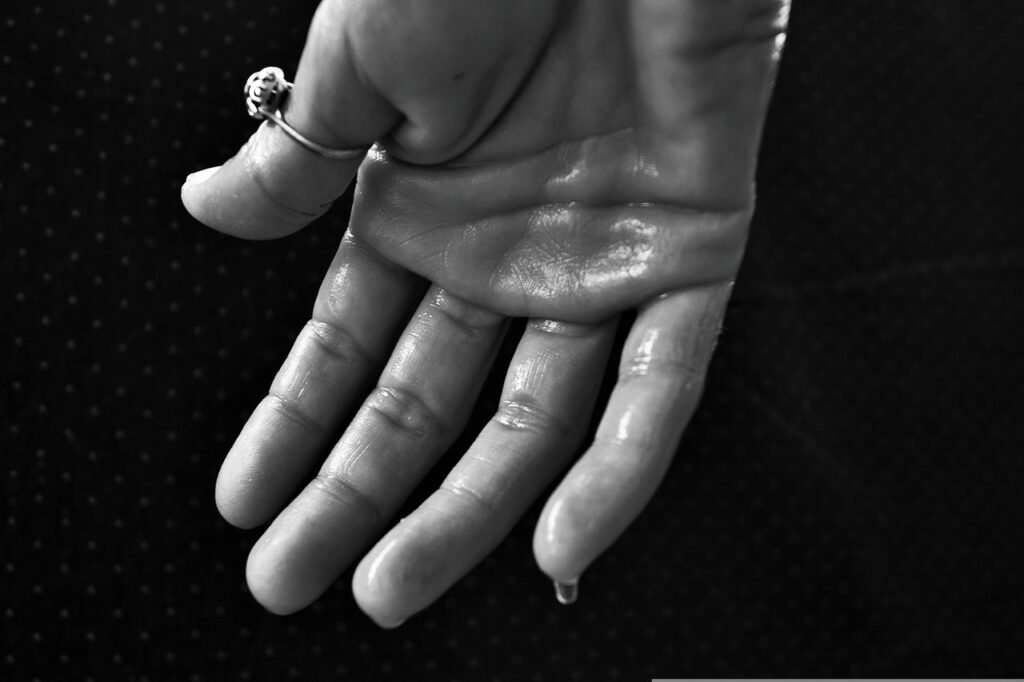 hand, hyperhidrosis, sweating-1502242.jpg