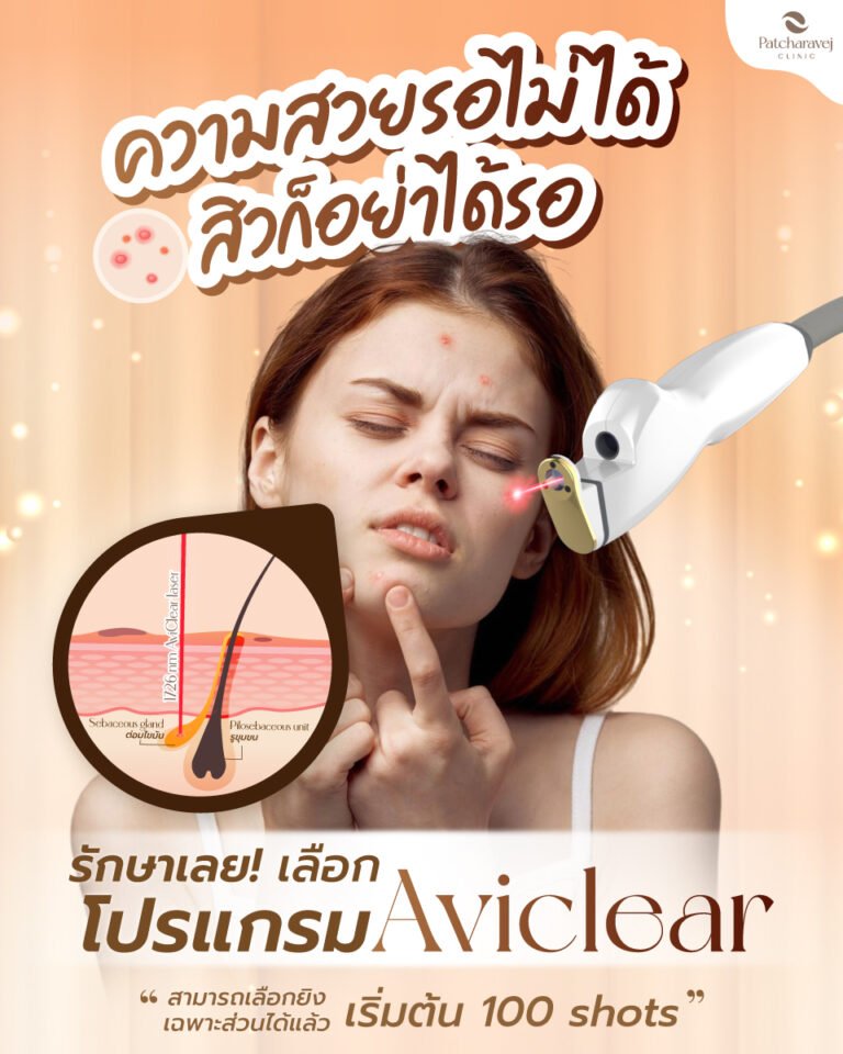 Aviclear สิว
